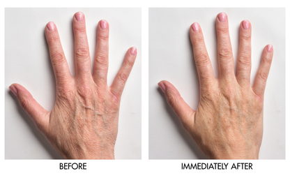 Genie Instant Hand Perfecter