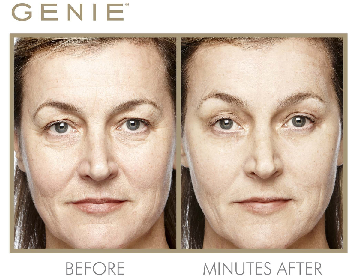 Instant Line Smoother Duo